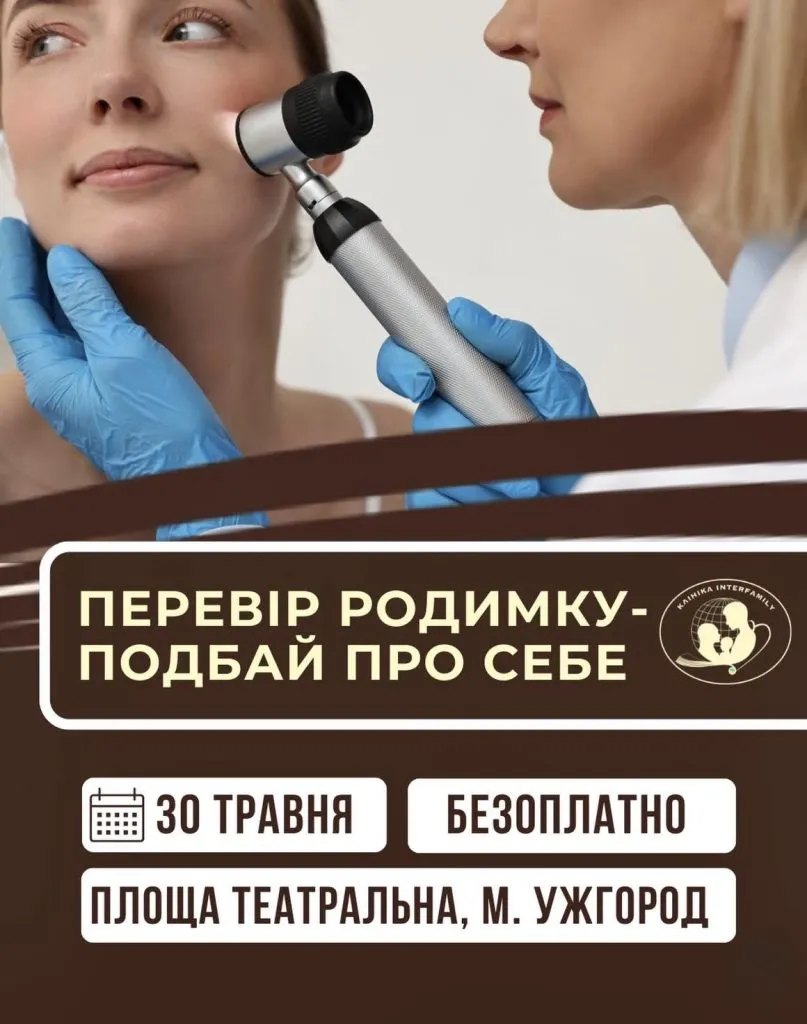 У Ужгороді відбудеться безкоштовна діагностика родимок напередодні Всесвітнього дня меланоми У Ужгороді відбудеться безкоштовна діагностика родимок напередодні Всесвітнього дня меланоми