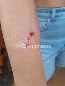 В Ужгороді домашній пес напав на власників